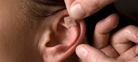acupunture-auriculotherapy