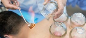 treatments-cupping