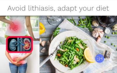 PREVENT KIDNEY STONE FORMATION THROUGH DIET